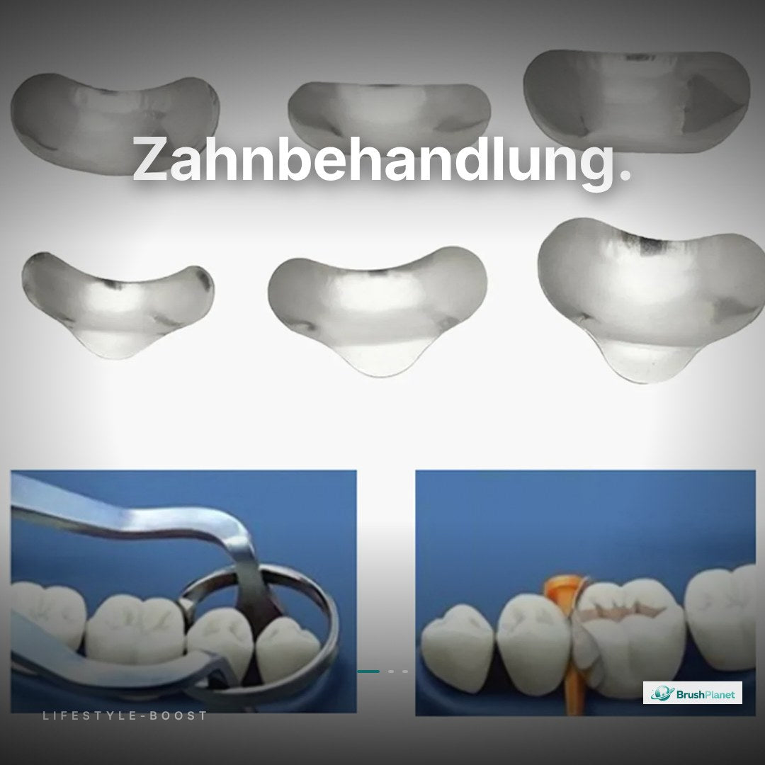 Dental-Matrizenbänder 100 Stück – Sektionale Metallmatrizen 50μm für Zahnrestaurationen
